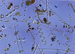 Figure 3. A natural phytoplankton sample from the strait showing the range of sizes of diatoms that are mostly present as a chain of cells. Courtesy David Cassis